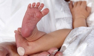 Fenilcetonuria, una enfermedad metabólica poco frecuente