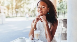 El vitiligo, una enfermedad de la piel muy compleja