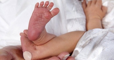 Fenilcetonuria, una enfermedad metabólica poco frecuente