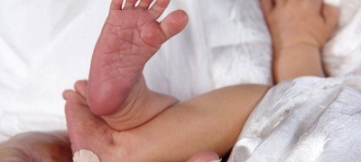 Fenilcetonuria, una enfermedad metabólica poco frecuente