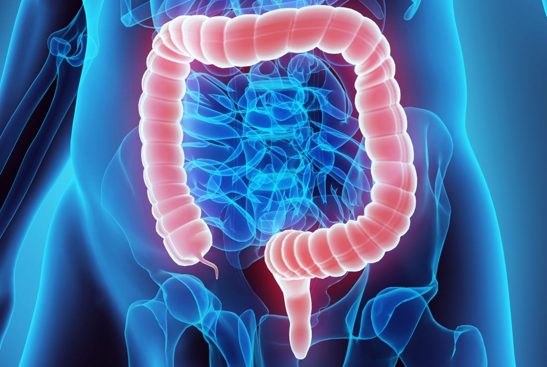 31 de marzo: Día Mundial contra el Cáncer de Colon