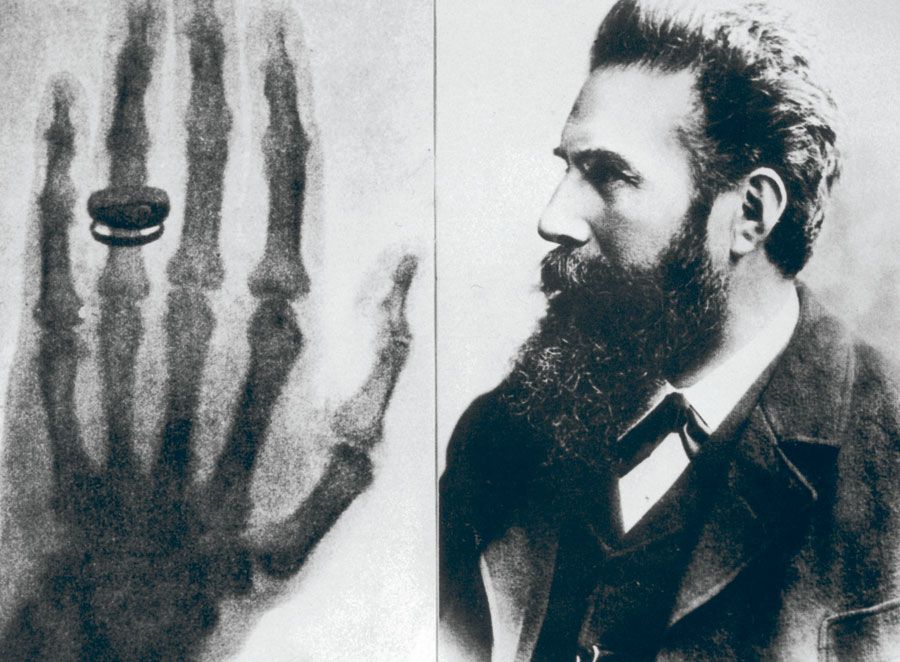 El día en que Wilhelm Roentgen descubrió los rayos X