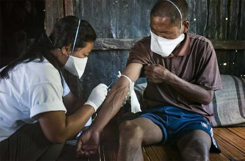 Concurso interno para jefe del Programa de Tuberculosis