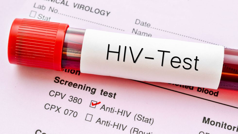 Test gratuito de detección de VIH, sífilis y hepatitis, este jueves en Salta