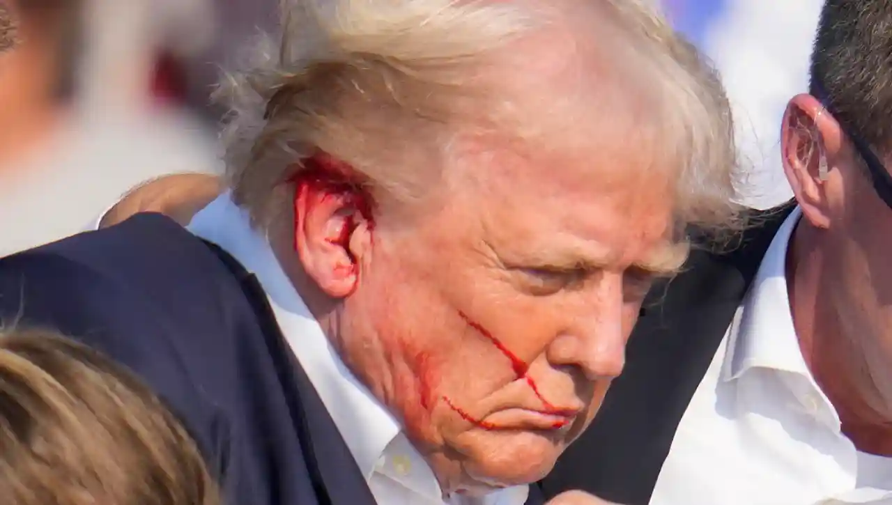 Donald Trump, herido