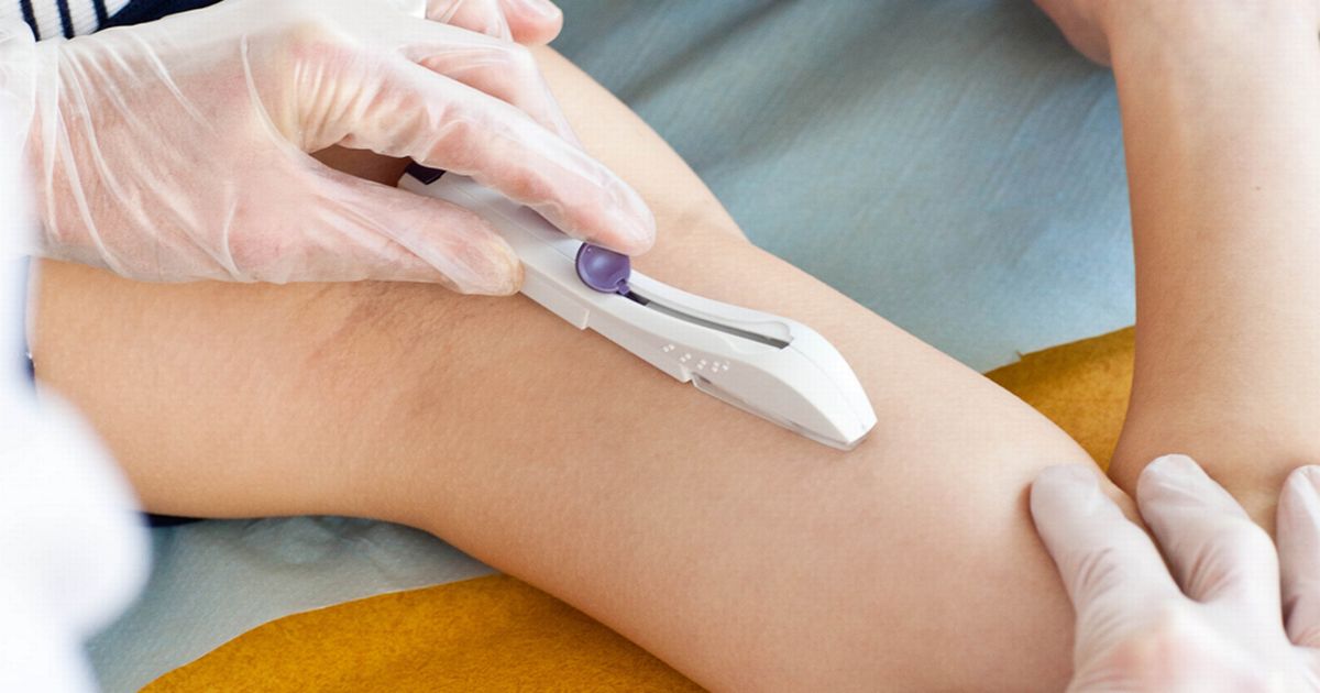 Colocación del anticonceptivo hormonal subdérmico, hoy en Villa San Antonio