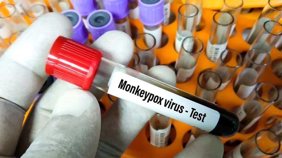 El Ministerio de Salud confirma 24 los casos de viruela del mono en la Argentina