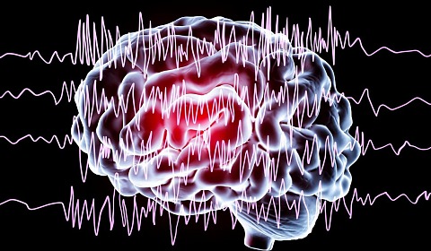 Curso de actualización en epilepsia para enfermeros en el hospital Materno Infantil de Salta Imagen ilustrativa