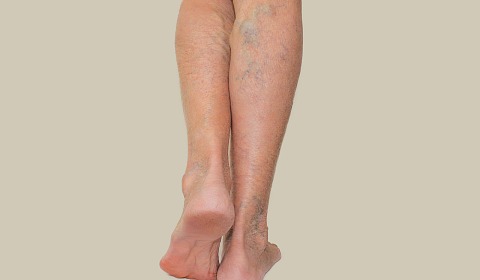 De pies a cabeza, tome el control: Proteja su salud, prevenga la trombosis